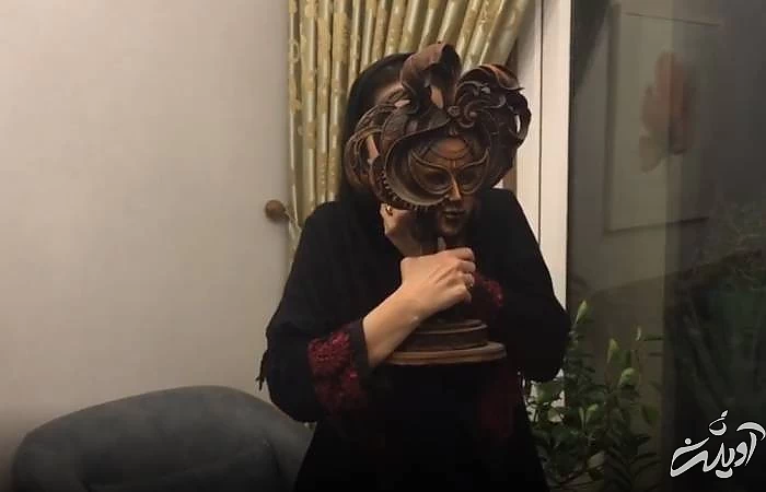 خطای پزشکی روی صورت سحر جعفری جوزانی فلج شدن صورت سحر جعفری جوزانی